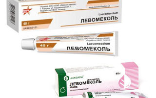 Прыщи на попе. как убрать их Прыщи на попе. как убрать их
