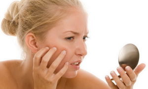 Как избавиться от шелушения кожи на лице – полезные советы и рецепты